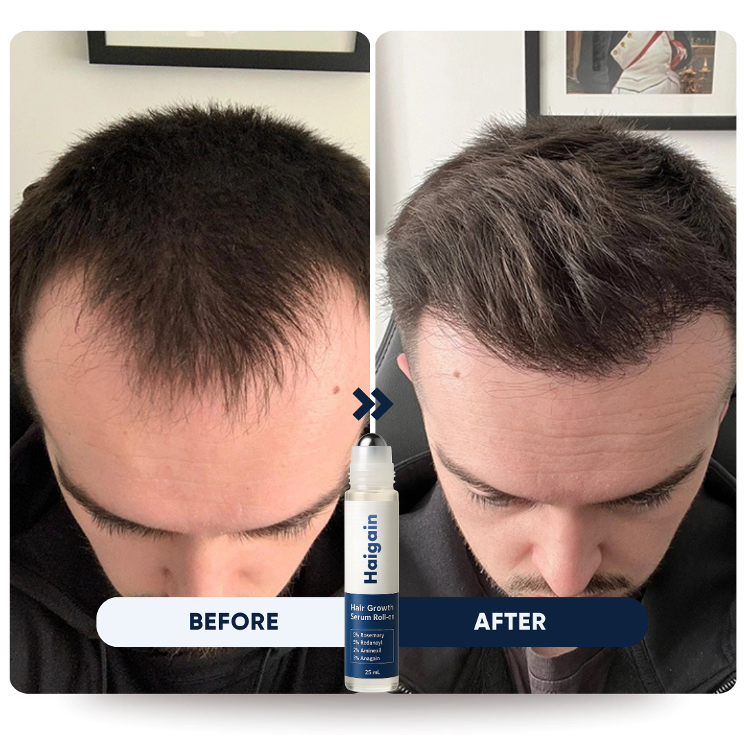 Hairline Recovery Roll-on