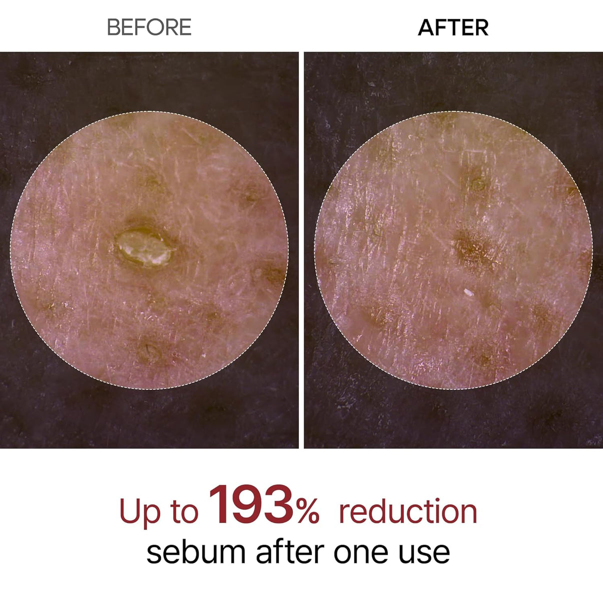 Rice Peel Duo – Smooth, Glowing Skin Fast