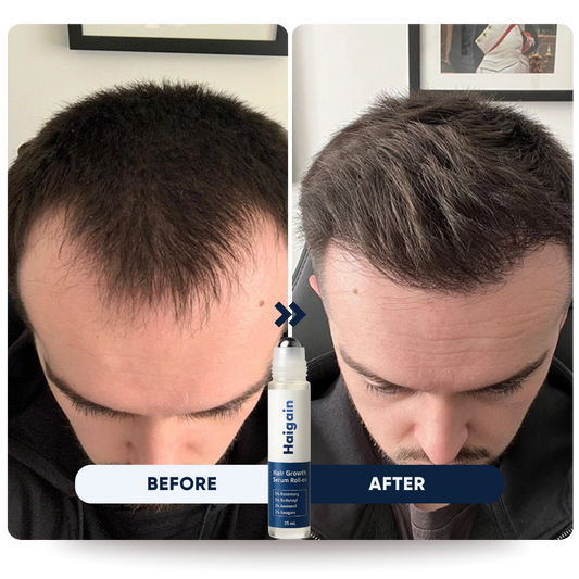 Hairline Recovery Roll-on